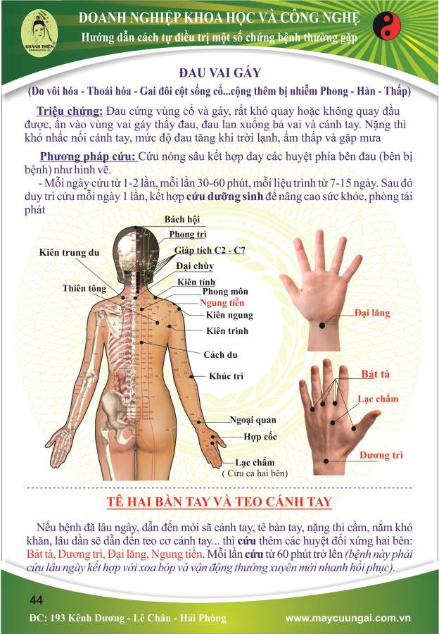 Máy cứu ngải : Cứu đau vai gáy.