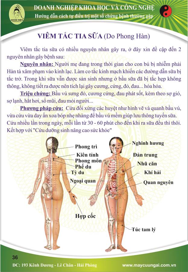 Máy cứu ngải : Cứu viêm tắc sữa( Do phong hàn - Do can khí uất kết ). 