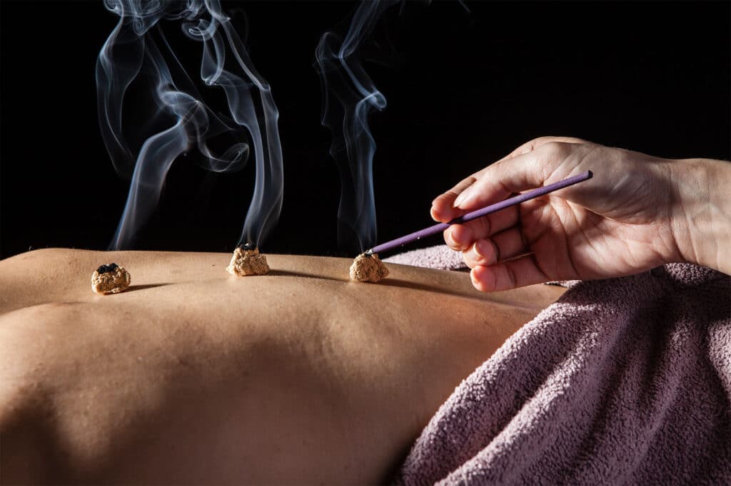Ngải cứu được dùng để giảm sưng đau hiệu quả và nhanh chóng