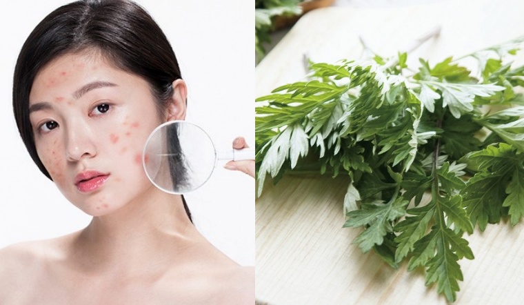 Ngải cứu có tác dụng gì cho da? Một số lưu ý khi dùng ngải cứu làm đẹp