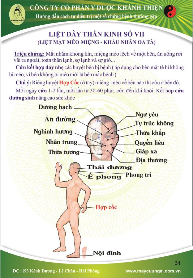 Máy cứu ngải: Cứu liệt dây thần kinh số VII