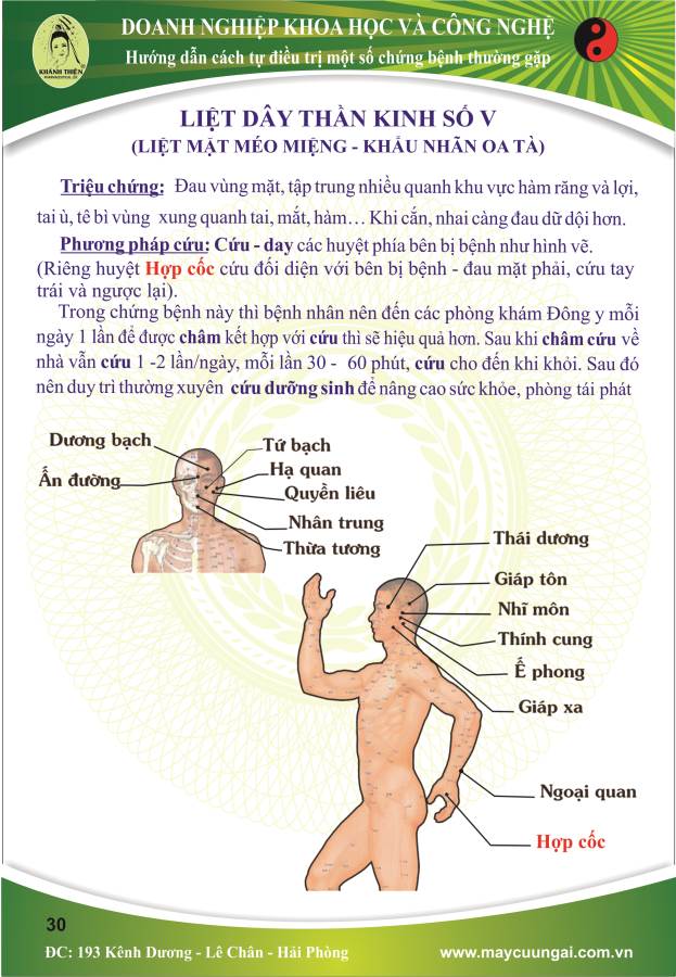 Máy cứu ngải: Cứu liệt dây thần kinh số V