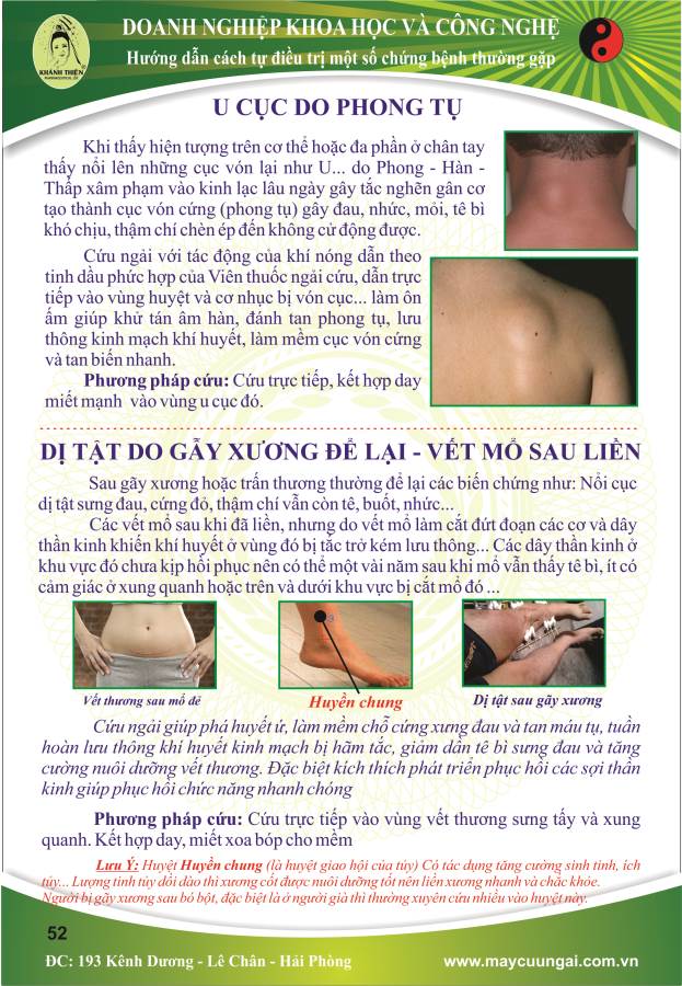 Máy cứu ngải: Cứu U cục do phong tụ - Dị tật do gãy xương vết mổ sau liền.