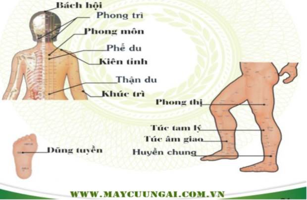 Cứu ngải dự phòng trúng phong