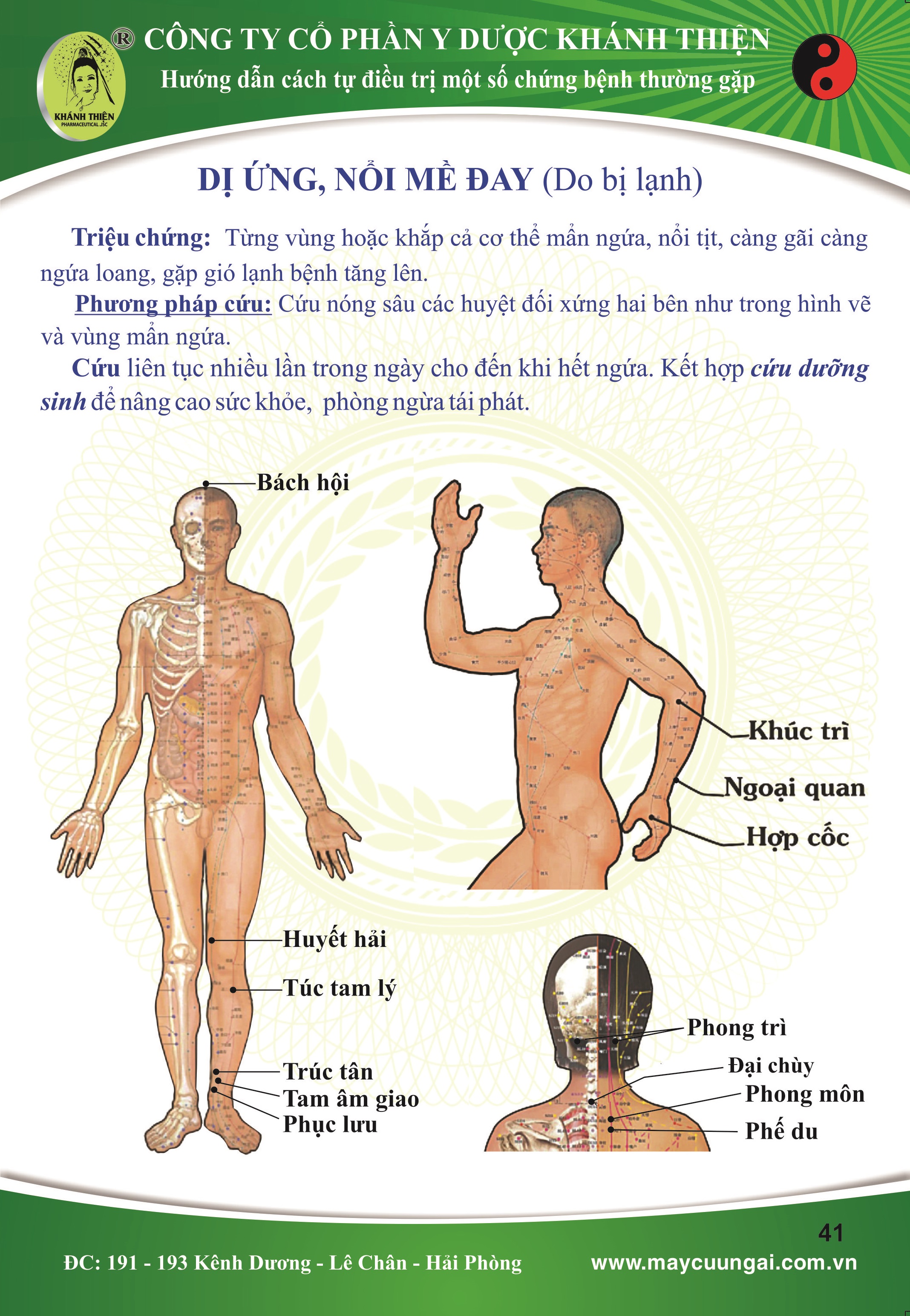 DỊ ỨNG NỔI MỀ ĐAY (do bị lạnh)