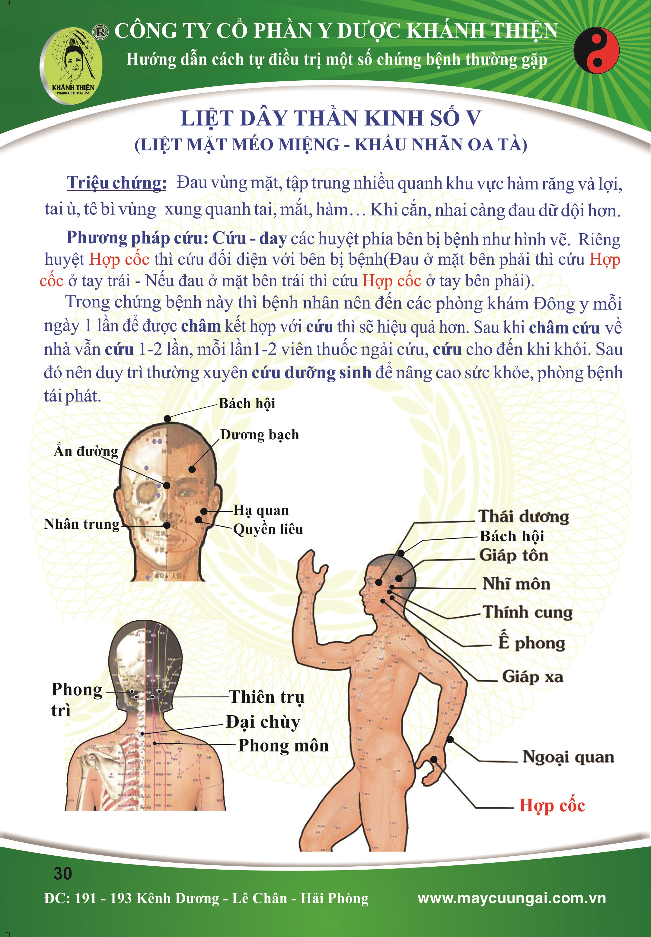 LIỆT DÂY THẦN KINH SỐ V (liệt mặt méo miệng - khẩu nhãn oa tà)